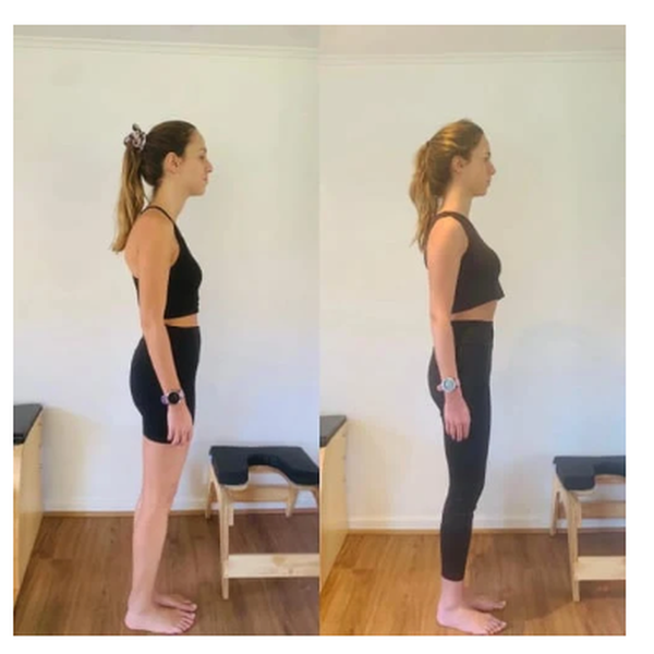 Sarah Mitchell posture before and after